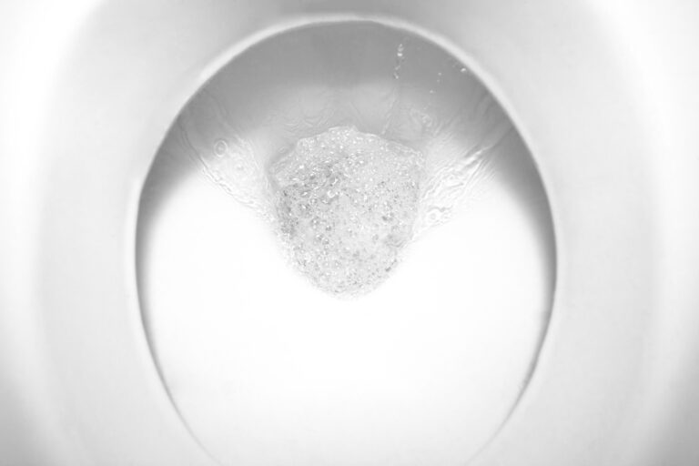 My Toilet Won't Stop Running What Is Causing the Problem